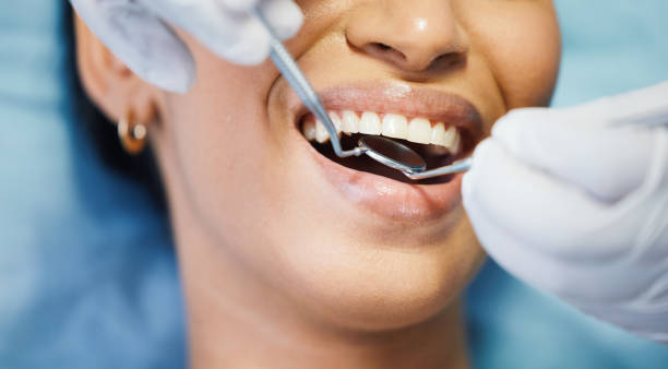 Best Emergency Root Canal Therapy in Eastover, NC